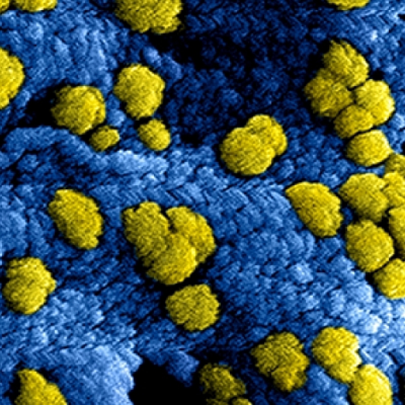 Informatie over coronavirus ( COVID-19)